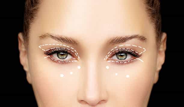 Eyelid surgery