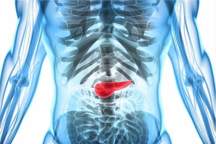 Pancreatic cancer