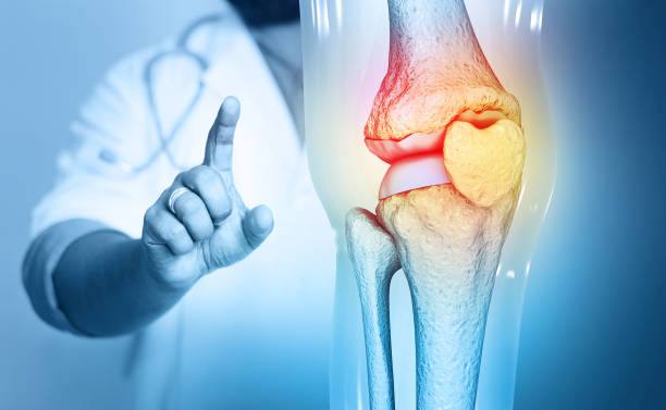 Symptoms of osteoarthritis