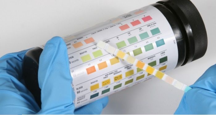 Urinary Tract Infections